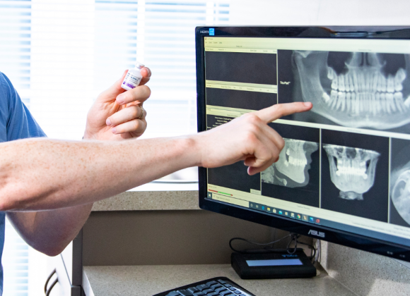 Doctor holding an Exparel vial while pointing to a wisdom teeth x-ray on a screen.