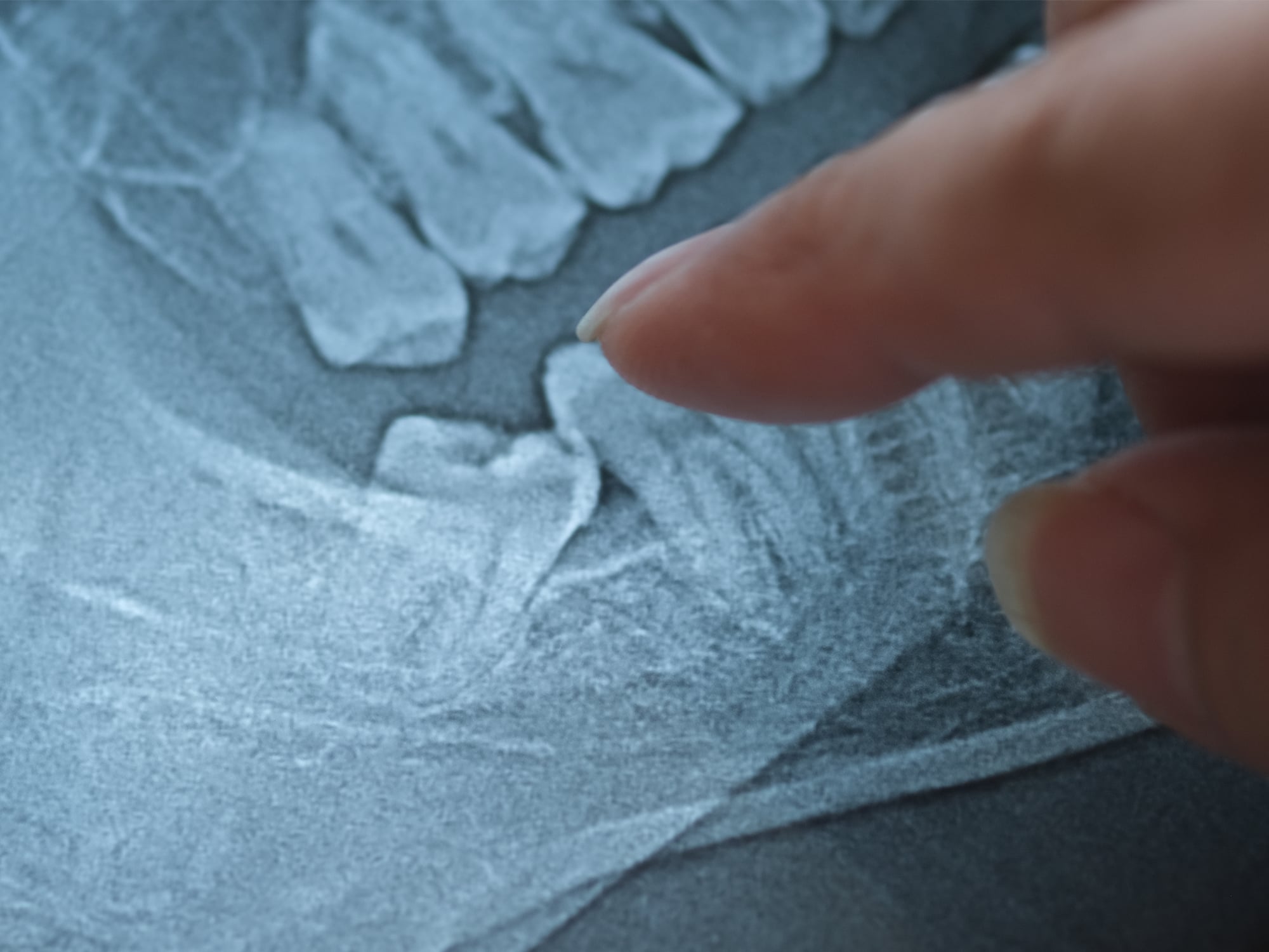 A person's finger points to a dental X-ray, highlighting a wisdom tooth visible among other teeth in the image.