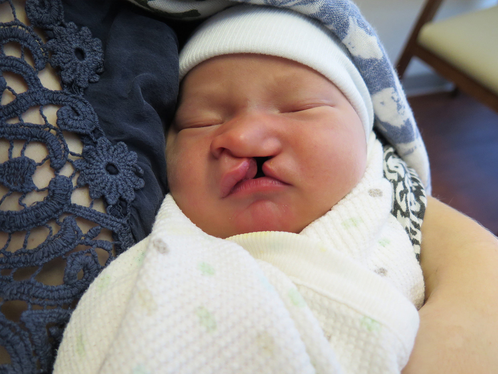 Cleft & Craniofacial Patient Transformation Journey