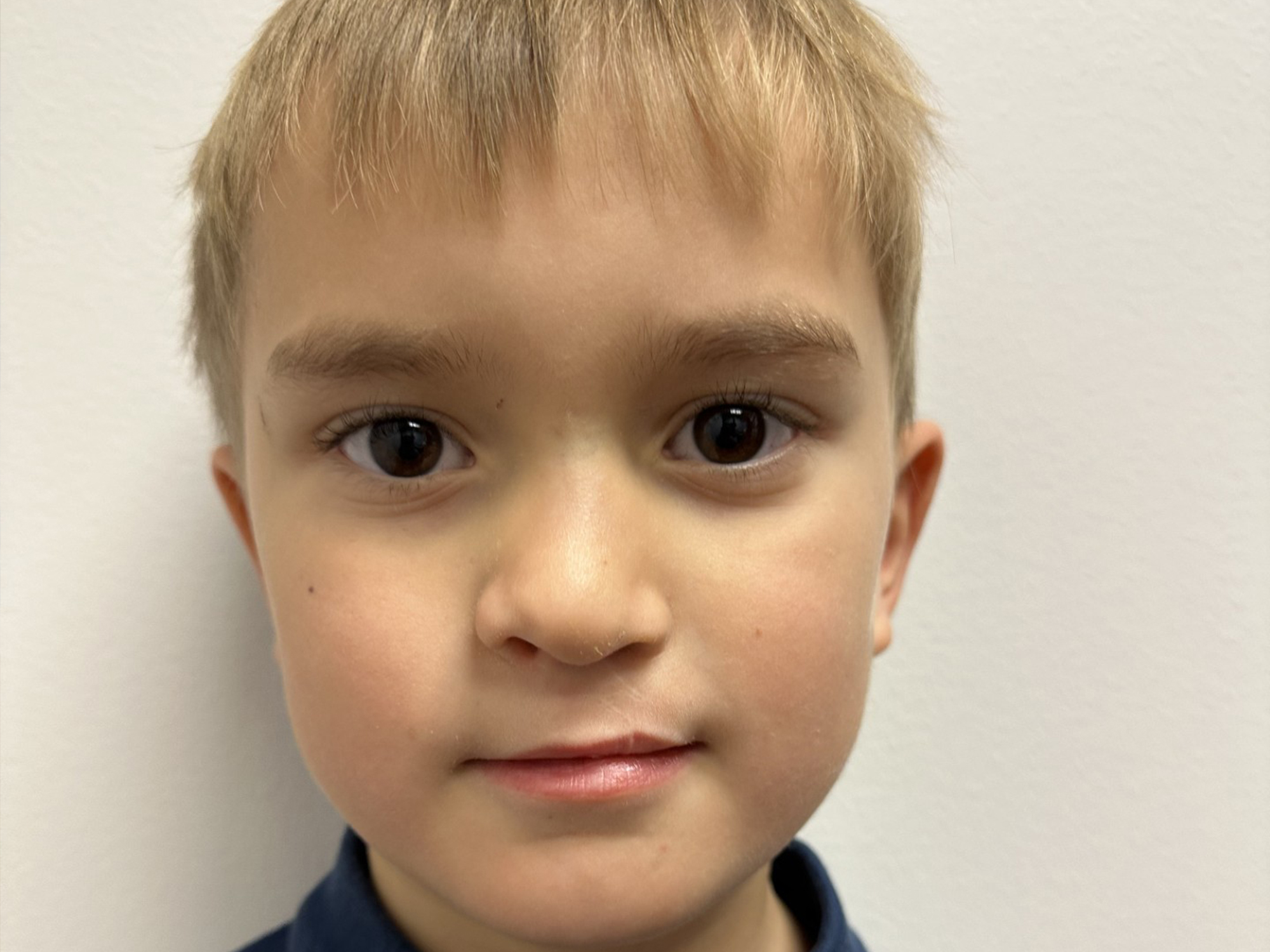 Cleft & Craniofacial Patient Transformation Journey